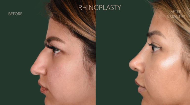 Comprehensive Cosmetic Surgery Options in Chicago: Body & Facial Refinement with Expert Care